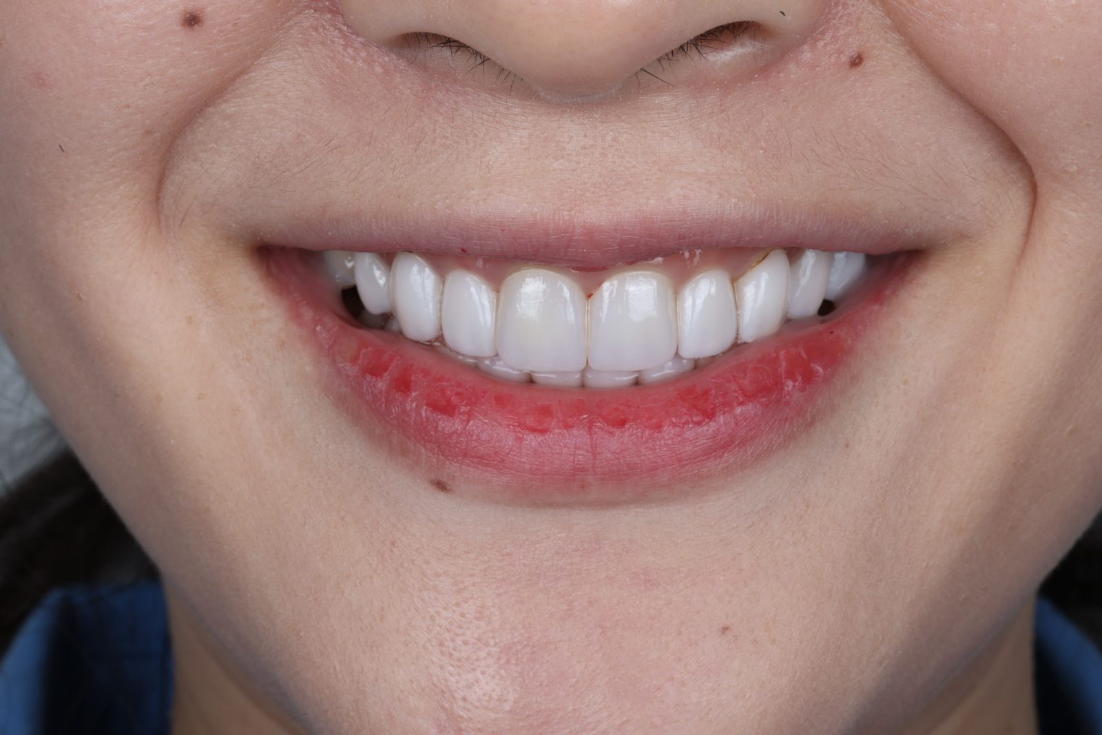 Our Treatments A confident, natural smile